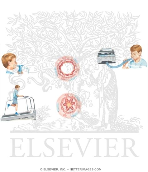 Watermarked preview of unlabeled image: Adjunctive Diagnostic Testing In Asthma