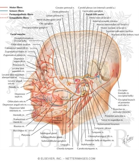 Watermarked preview of labeled image: Facial nerve (VII)