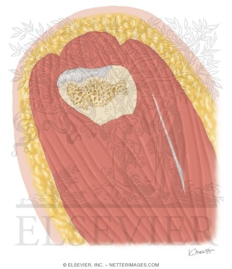 Watermarked preview of unlabeled image: Cross Section of the Shoulder: Sagittal View