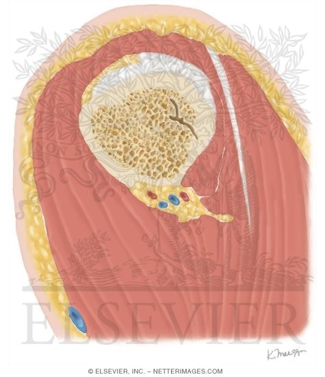 Watermarked preview of unlabeled image: Cross Section of the Shoulder: Sagittal View