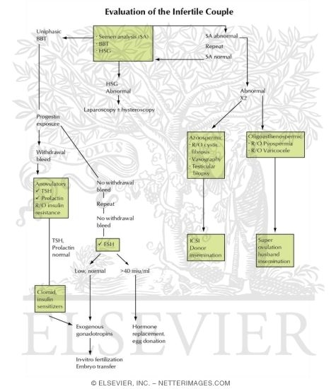 Watermarked preview of unlabeled image: Evaluation of the Infertile Couple