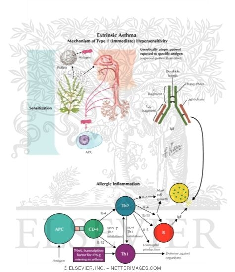 Extrinsic Asthma