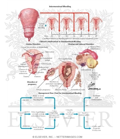 Watermarked preview of labeled image: Intermenstrual Bleeding
Menorrhagia