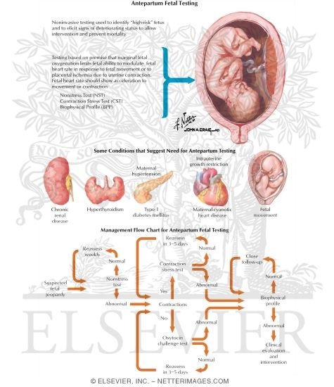 Watermarked preview of labeled image: Antepartum Fetal Testing