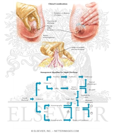 Watermarked preview of labeled image: Nipple Discharge
Breast: Nipple Discharge