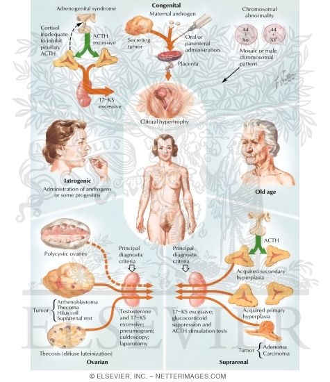 Hirsutism and Virilization