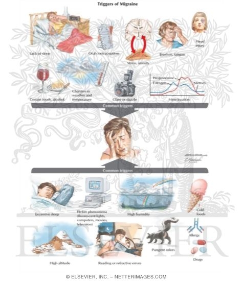 Watermarked preview of labeled image: Headache: Tension, Cluster, and Migraine
