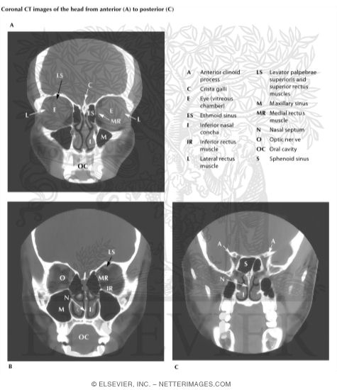 Head Scans: Coronal CT Images
