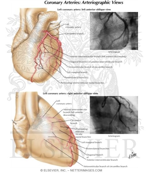 Watermarked preview of labeled image: Selective Cine Coronary Arteriography