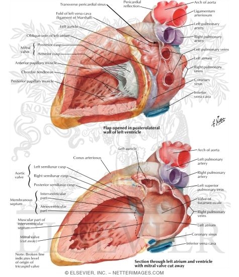 Watermarked preview of labeled image: Left Atrium and Left Ventricle