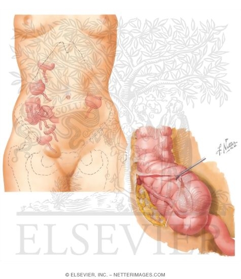 Vermiform Appendix