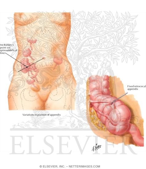 Vermiform Appendix