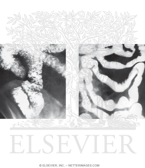 Watermarked preview of unlabeled image: Small Intestine: Radiographs