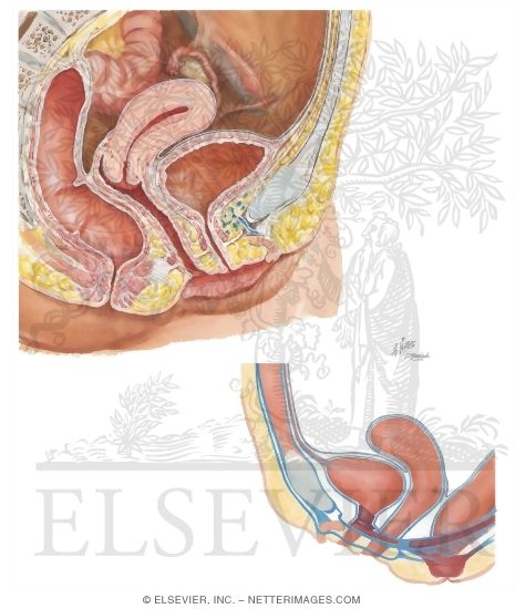 Bladder
