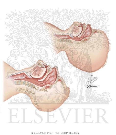 Watermarked preview of unlabeled image: Pediatric and Adult Airway Anatomy