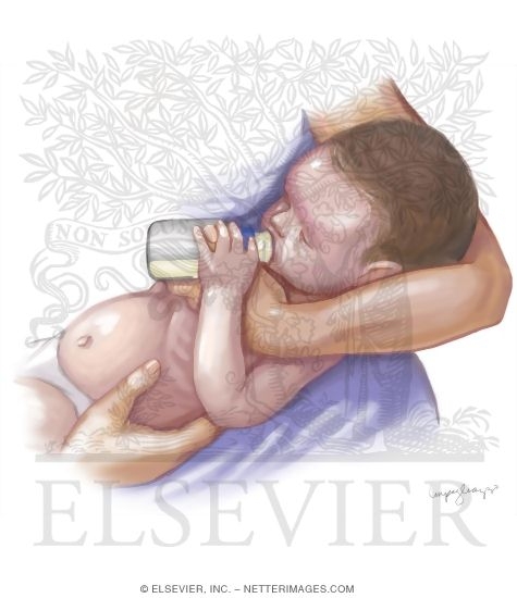Watermarked preview of unlabeled image: Etiology and Presentation of Heart Failure In a Baby