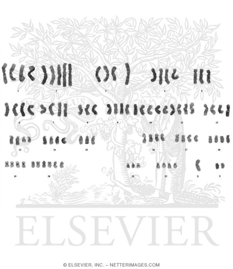 Watermarked preview of unlabeled image: Chromosomes