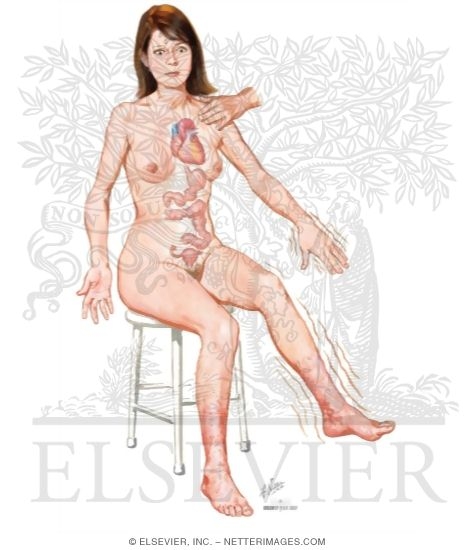Watermarked preview of unlabeled image: Clinical Features of Hyperthyroidism
