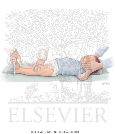Proper Measurement Techniques: Supine Length