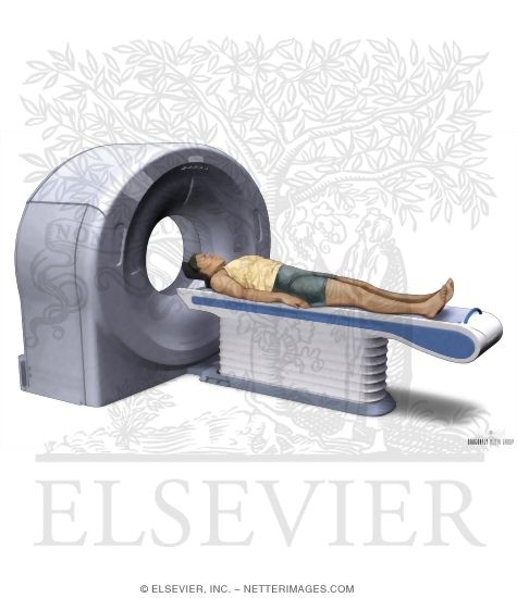 Watermarked preview of unlabeled image: Computed Tomography (CT)
