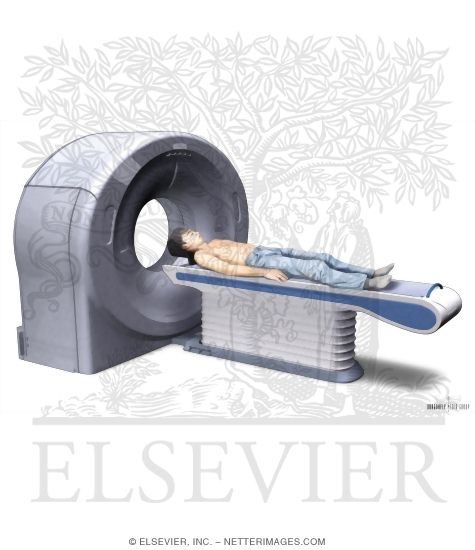 Watermarked preview of unlabeled image: Computed Tomography (CT)