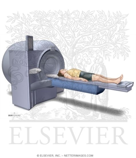 Watermarked preview of unlabeled image: Magnetic Resonance Imaging (MRI)