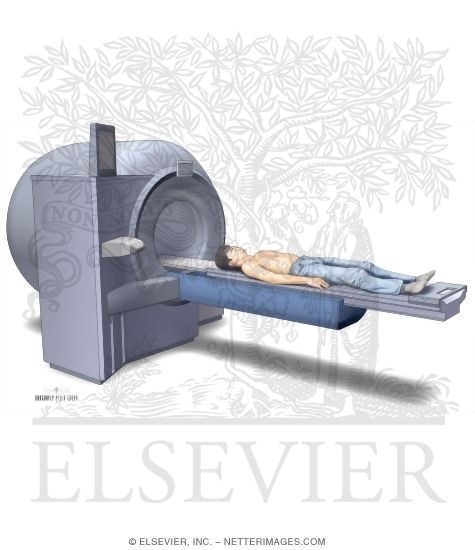 Watermarked preview of unlabeled image: Magnetic Resonance Imaging (MRI)