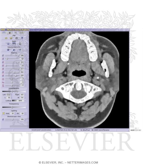 Imaging Software
