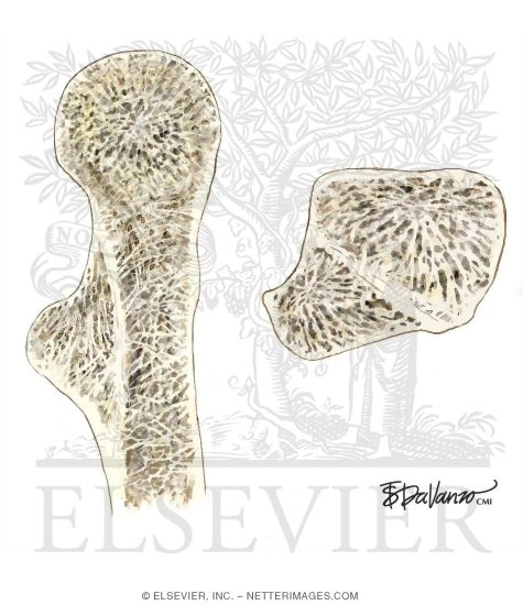 Watermarked preview of unlabeled image: Proximal Femur Osteology