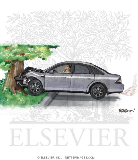 Watermarked preview of unlabeled image: Car