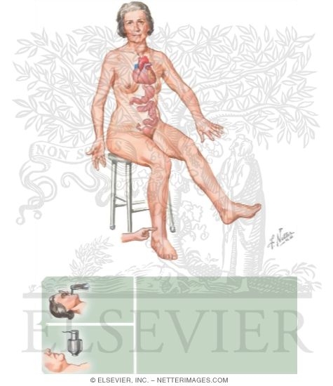 Clinical Manifestations of Toxic Adenoma and Toxic Multinodular Goiter