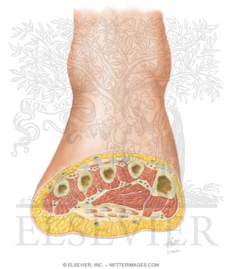 Cross Section of Foot