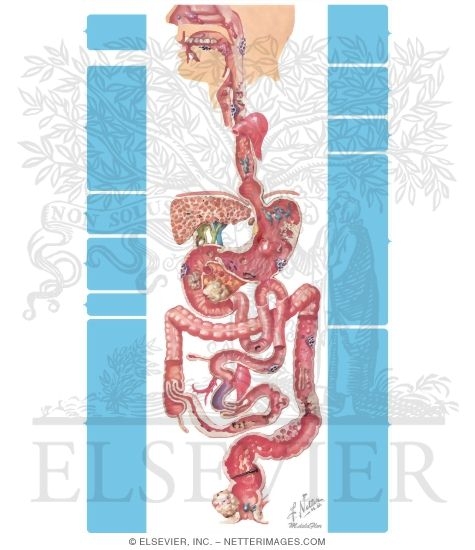 Watermarked preview of unlabeled image: Intestinal Bleeding