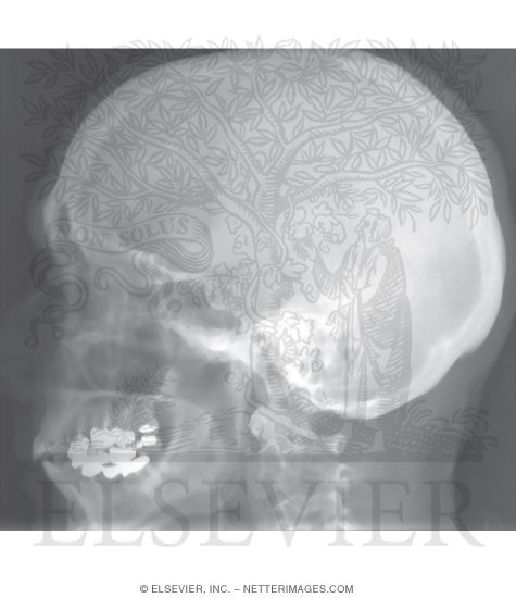 Skull: Lateral Radiograph