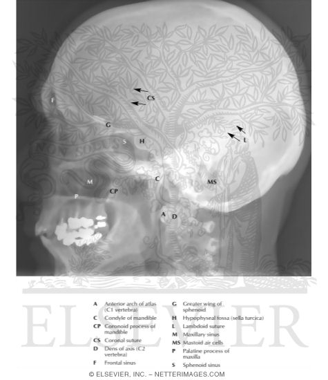 Skull: Lateral Radiograph