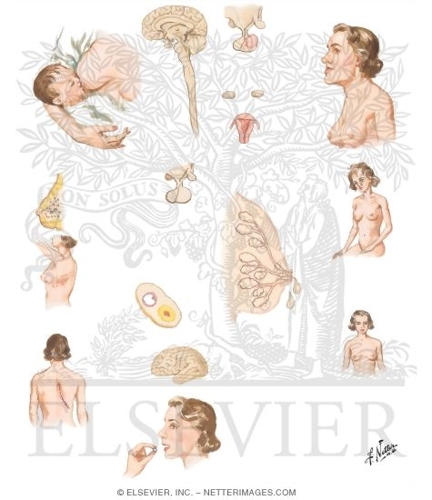 Watermarked preview of unlabeled image: Galactorrhea