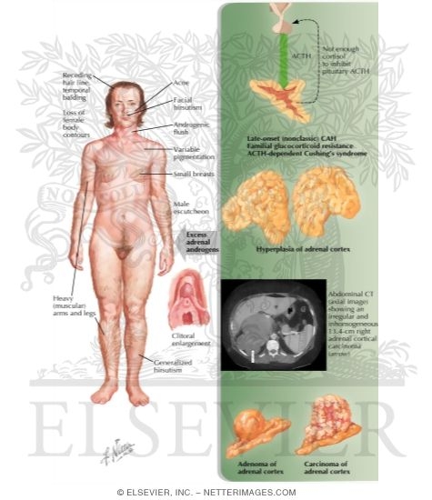 Adult Androgenital Syndromes