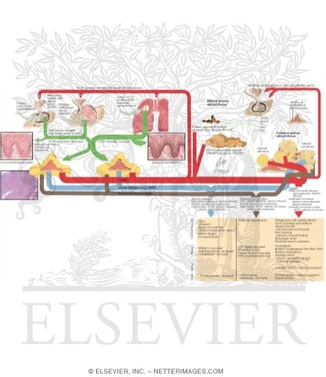 Cushing Syndrome: Pathophysiology