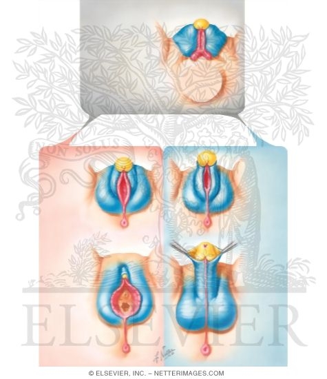 Watermarked preview of unlabeled image: Homologues of External Genitalia
