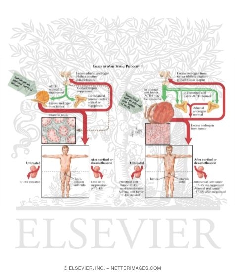 Watermarked preview of labeled image: Sexual Precocity in the Male