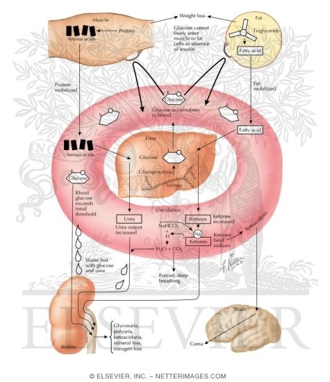 Consequences of Insulin Deprivation