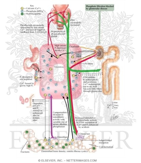 Watermarked preview of labeled image: Renal Osteodystrophy