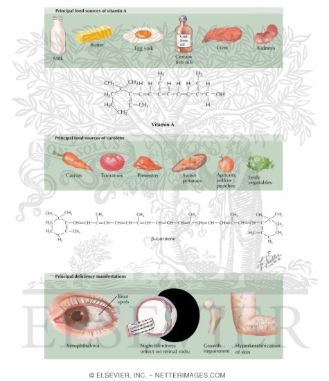 Watermarked preview of labeled image: Vitamin A Deficiency