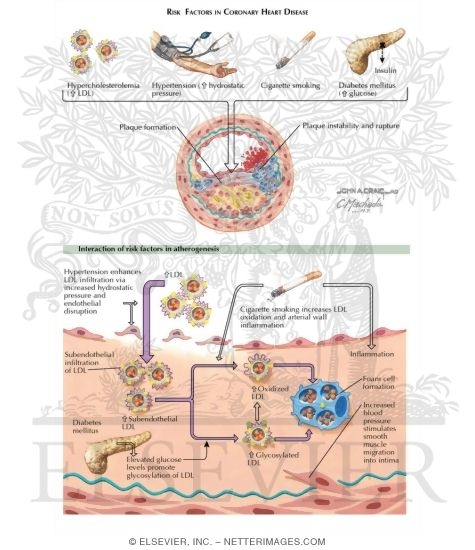 Watermarked preview of labeled image: Risk Factors in Coronary Heart Disease
