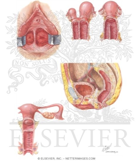 Congenital Anomalies