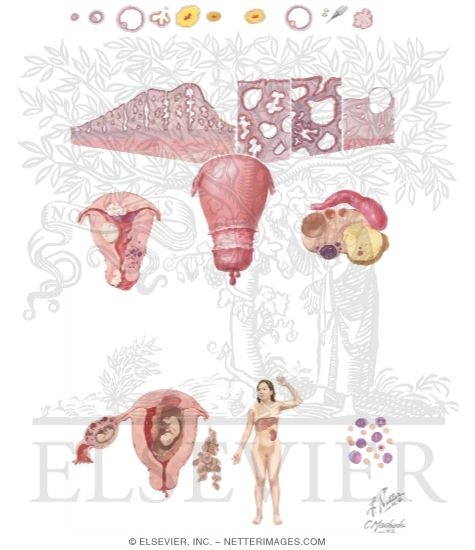 Watermarked preview of unlabeled image: Causes of Uterine Bleeding