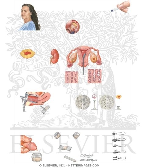 Watermarked preview of unlabeled image: Infertility II - Evaluation of the Female