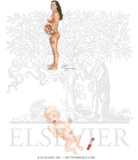 Intrauterine Growth Restriction