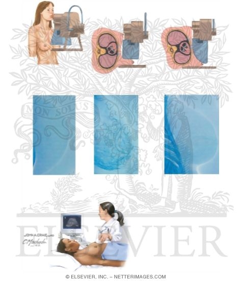Watermarked preview of unlabeled image: Breast Imaging