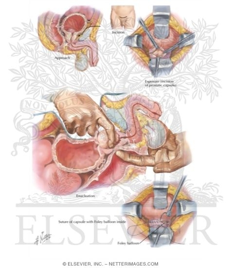 The Netter Collection of Medical Illustrations - Reproductive ...